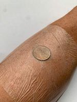 Transparent Film Dressing - 10 - Waterproof Gauze Free Bandage Packs - 4 x 4 3/4 inches (10 x 12cm) - Clear Shower Moisture Barrier Patch, Shield for Catheters, Ports and Wounds, Tattoo Supply