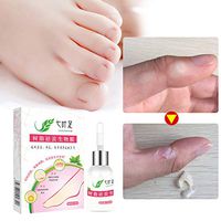 Warts Removal Ointment, Zhengpin Foot and Hand Care From Ancient Chinese Medicine Formula (A)