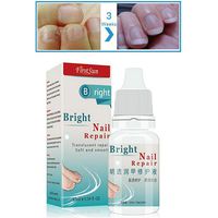 3pcs Fungus Nail Treatment Anti Fungal Treatment Cream Strength Toenail Fungus Foot Nail, Onychomycosis Paronychia Pain Relief Nail Infection Natural Nail Care - 10ml