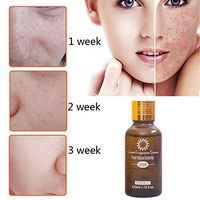 Freckle Lighten Essential Oil, Elevin(TM) Blemish Essential Oil Decomposition Pigment Whiten Moisturizing Anti Wrinkle (50ml)
