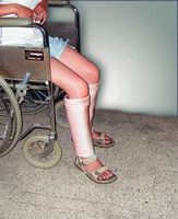 Sammons Preston DermaSaver Leg (Shin/Knee, Large)