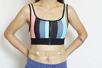 Peritoneal Dialysis Belt-Buckle Type (Nude)