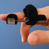 Bunnell Modified Safety Pin Splint - Large