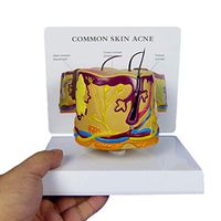 LXX Skin Model,Hair Follicle Hair Anatomy Model Acne Pustule Blackhead for Science Classroom Study Display Teaching Medical Model