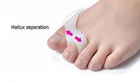 Ocamo 1 Pair Foot Care Tool Silicone Thumb Toe Dual Ring Separators Spacer Straightener