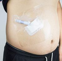 Shower Shield 8" x 8" PICC Line Cover Moisture Barrier，Wound Dressing -One Week Supply (7 Pack)