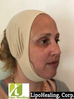 Facial Compression & Chin Support Continual Chin Support Light Compression ONE Size Beige Lipofoam Strips and Wipes Included by LipoHealing, Corp. Unisex