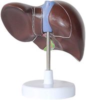 LXX Scientific Human Liver Anatomical Model - 1.5X Magnified Hepatobiliary Model Pancreatic Gallbladder Model Bile Duct - for mediacl Educational Training Aid