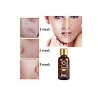 Freckle Lighten Essential Oil, Elevin(TM) Blemish Essential Oil Decomposition Pigment Whiten Moisturizing Anti Wrinkle (30ml)