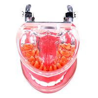 LXX Periodontal Disease Dental Model - Teeth Typodont Study Teaching Model - Demonstration Tooth Model for Patient Education