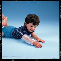 Urias Pressure Splints ADULT: Splints: Elbow, Approx. Max Circ.: 16 1/2" (42cm), Chambers: Single, L