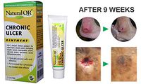 NaturalQR Chronic Ulcer Healing Cream | Developed by a Dermatologist | 100% Herbal and Ayurvedic Treatment for Chronic Ulcers, Pressure Sores, Bed Sores, and Rashes | 30 Gram Tube