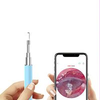 HD Visual Ear Spoon, Medical Grade Ear Canal Cleaning Tool, Ultra-fine Security Alarm Ear Spoon (Blue)