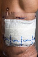 12" x 24" AquaGuard PICC Line Cover Moisture Barrier