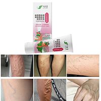 New Varicose Veins Treatment Cream, Relief Phlebitis Angiitis Inflammation Blood Vessel Spider Vein Health Care Ointment 60g