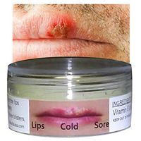 Cold Sore Treatment Silica Jelly Mouth Lips Herpes Blisters Cankers Fungus (10 ml) ALKAVITA