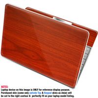 decalrus Protective Decal Skin Skins Sticker for HP EliteBook Folio 9470m 14" Screen (Important Note: Compare Your Laptop to Identify Image for Correct Model) case Cover EliteBook9470m-2PS-603