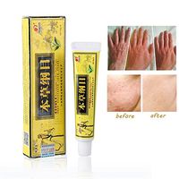 Angmile Chinese Herbal Eczema Cream, Psoriasis Creams Dermatitis And Eczema Pruritus Psoriasis Ointment (10 Pcs)