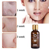 Freckle Lighten Essential Oil, Elevin(TM) Blemish Essential Oil Decomposition Pigment Whiten Moisturizing Anti Wrinkle (10ml)