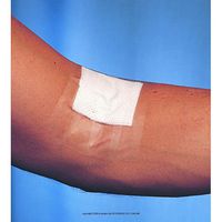 3M™ Blenderm™ Tape-Size: 1" x 5 yd (2.5 cm x 4.5 m) - UOM = Each 1