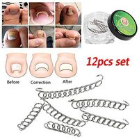Ugthe 6/12Pcs Ingrown Toenail Correction Wire Fixer Foot Care Pedicure Recover Tool - 12pcs