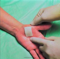 Tegaderm 3584 +Pad Film Dressing with Non-Adherent Pad, Box of 50