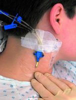 3M Tegaderm Transparent Film Dressing, Tegdrm Drs Trn 4X10 in, (1 BOX, 20 EACH)