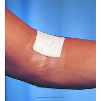 3M Blenderm Tape, Blenderm Plstc Tape 1 in X5, (1 BOX, 12 EACH)