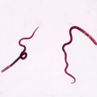 Trichinella spiralis Female, w.m. Microscope Slide