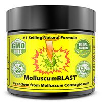 Molluscum Contagiosum Treatment Cream Kids Adults (15 Essential Oils & FDA Approved BHT) Vanishing Stick Natural Contagium Quickly Control Stop #1Selling LARGE 2oz 60ml 100% NATURAL FAST RELIEF