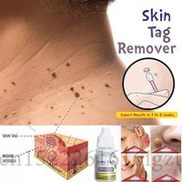 Skin Tag Remover 12 hours Tu kill Medical Tu kill Remover Skin Tag Mole & Genital Wart Remover Dropshipping