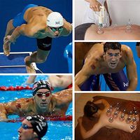 12 Cups Cupping Therapy Sets,Chinese Cupping Therapy Set Fire with Pump