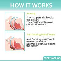 Anti Snoring Nose Vents Device - Set of 4 Silent Snore Stopper - Effective Snoring Solution - Mute Nasal Dilators Easy Breathing Snore Away Sleep Aids for Men & Women- Advanced Design by Let'sDream