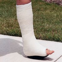 DM Systems Inc CastWalker, Regular Size Kit