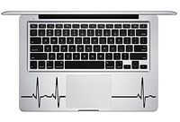 Heart Beat Trackpad Keyboard Apple Macbook Decal Vinyl Sticker Apple Mac Air Pro Retina Laptop sticker