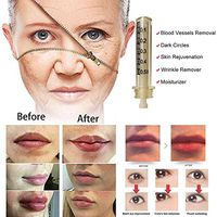 WANZZN Syringe Ampoule Head, for Hyaluron Gun Hyaluron Pen High Pressure Wrinkle Removal Water Syringe 0.5Ml 35Pcs