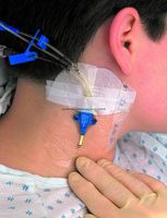 3m Tegaderm Transparent Dressing - Box Of 10 - Model 9506w - Quantity 2