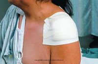 MICROFOAM TAPE ELSTC 4X5.5 YD 3M Microfoam Surgical Tape Box of 3 3M 15284