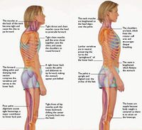 Posture Corrector for Children and Teenagers