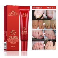 Foot Nail Cream, KOBWA Fungus Stop, Nail Fungus Treatments,Anti Fungus Nail Treatment,Nail Care Treatment of Anti-Fungal Cream,Effective Against Nail Fungus,Restores Toenail Fungus