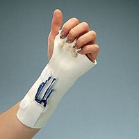 A6079 Phoenix Line Guides - 10 Per Pack