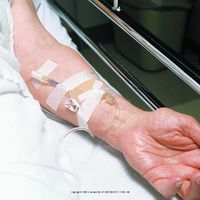 3M™ Durapore™ Surgical Tape-Size: 1/2" x 10 yd (1.25 cm x 9.14 m) - UOM = Case of 240