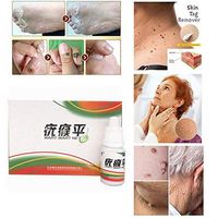 Skin Tag Wart Remover, Body Mole Warts Remover Body Warts Treatment Medical for Genital Warts, Moles, Skin Tags Remover Treatment 1 Packs