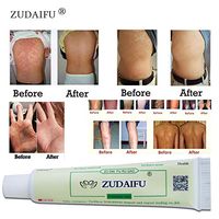 MAO YEYE 1PC Sulphur Soap Skin Repair Clearance Acne Psoriasis Seborrhea Eczema Anti Fungus Cream