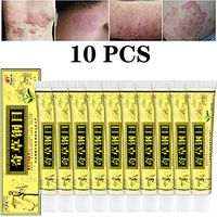 10pcs/Lot High Quality Chinese Herbal Eczema, Psoriasis Creams Dermatitis and Eczema Pruritus Psoriasis Ointment