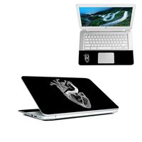 MightySkins Skin Compatible with HP Chromebook 14" (2018) - My Space | Protective, Durable, and Unique Vinyl Decal wrap Cover | Easy to Apply, Remove, and Change Styles | Made in The USA