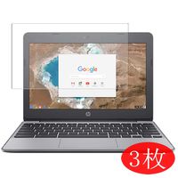 【3 Pack】 Synvy Screen Protector for HP Chromebook 11-v000 si / v031nr / v001na / v010nr / v020wm / v051sa / v025wm / v010wm / v032nr 11.6" Film Protective Protectors [Not Tempered Glass]