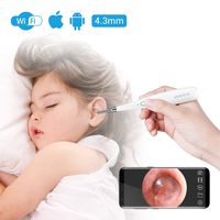 DEPSTECH Wireless Otoscope, 4.3mm Ultra-Thin WiFi HD Ear Inspection Camera, Ear Scope Earwax Mite Cleaning Tool with 6 Adjustable LED Lights for iPhone, iPad & Android Smart Phones