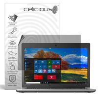 Celicious Privacy Plus 4-Way Anti-Spy Filter Screen Protector Film Compatible with Toshiba Tecra Z40-C