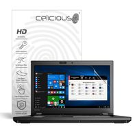 Celicious Vivid Plus Mild Anti-Glare Screen Protector Film Compatible with Lenovo ThinkPad P52 (Touch) [Pack of 2]